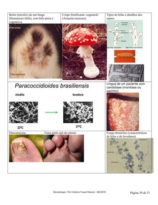 Microbiologia - Prof. Américo Focesi Pelicioni - 28/2/2019 Página 39 de 51
Bolor (micélio) de um fungo
filamentoso (hifa), com hifa aérea e
vegetativa.
Corpo frutificante: cogumelo
(Amanita muscara)
Tipos de hifas e detalhes dos
septos
Paracoccidioides brasiliensis
23ºC 37ºC
micélio levedura
23ºC 37ºC
micélio levedura
Fungos DimFungos Dimóórficosrficos
Língua de um paciente com
candidíase (monilíase ou
sapinho)
Onicomicose: Tinea pedis (pé-de-atleta) Fungo dimórfico (características
de hifas e de leveduras)
 