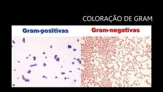 COLORAÇÃO DE GRAM
 