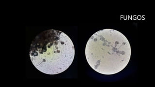 FUNGOS
 