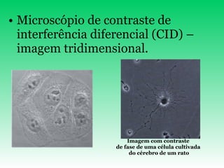 Microscópio de contraste de interferência diferencial (CID) – imagem tridimensional.                                                               Imagem com contraste  de fase de uma célula cultivada  do cérebro de um rato 