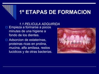 1º ETAPAS DE FORMACION
1.1 PELICULA ADQUIRIDA
 Empieza a formarse a pocos
minutes de una higiene a
fondo de los dientes.
 Adsorcion de estaterinas,
proteinas ricas en prolina,
mucina, alfa amilasa, restos
lucidicos y de otras bacterias.
 