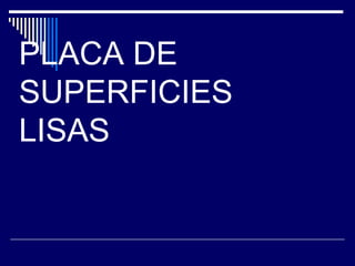 PLACA DE
SUPERFICIES
LISAS
 