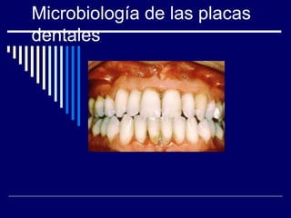 Microbiología de las placas
dentales
 