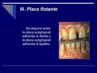 III. Placa flotante
Se dispone entre
la placa subgingival
adherida al diente y
la placa subgingival
adherida al epitelio.
 