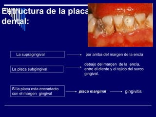 Estructura de la placa
dental:
La placa subgingival
Si la placa esta encontacto
con el margen gingival
debajo del margen de la encía,
entre el diente y el tejido del surco
gingival.
La supragingival por arriba del margen de la encía
placa marginal gingivitis
 