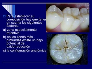  Para establecer su
composición hay que tener
en cuenta los siguientes
factores:
a) zona especialmente
retentiva
b) en las zonas más
profundas existe un bajo
potencial de
oxidorreducción
c) la configuración anatómica
 
