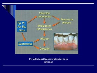 Periodontopatógenos implicados en la
infección
 
