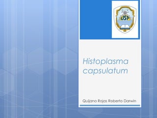 Histoplasma
capsulatum


Quijano Rojas Roberto Darwin
 