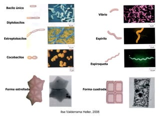 Bacilo único Diplobacilos Estreptobacilos Cocobacilos Vibrio Espirilo Espiroqueta Forma estrellada Forma cuadrada 