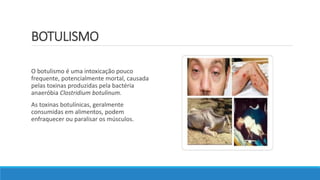 BOTULISMO
O botulismo é uma intoxicação pouco
frequente, potencialmente mortal, causada
pelas toxinas produzidas pela bactéria
anaeróbia Clostridium botulinum.
As toxinas botulínicas, geralmente
consumidas em alimentos, podem
enfraquecer ou paralisar os músculos.
 