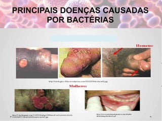 PRINCIPAIS DOENÇAS CAUSADAS
POR BACTÉRIAS
 