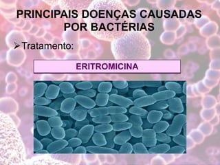 PRINCIPAIS DOENÇAS CAUSADAS
POR BACTÉRIAS
Tratamento:
ERITROMICINA
 