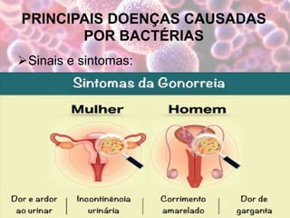 PRINCIPAIS DOENÇAS CAUSADAS
POR BACTÉRIAS
Sinais e sintomas:
 