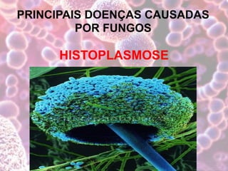 PRINCIPAIS DOENÇAS CAUSADAS
POR FUNGOS
HISTOPLASMOSE
 