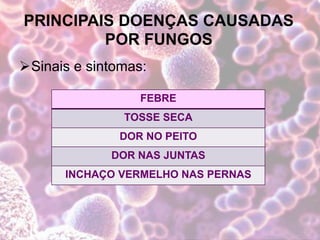 PRINCIPAIS DOENÇAS CAUSADAS
POR FUNGOS
Sinais e sintomas:
FEBRE
TOSSE SECA
DOR NO PEITO
DOR NAS JUNTAS
INCHAÇO VERMELHO NAS PERNAS
 