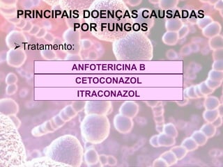 PRINCIPAIS DOENÇAS CAUSADAS
POR FUNGOS
Tratamento:
ANFOTERICINA B
CETOCONAZOL
ITRACONAZOL
 