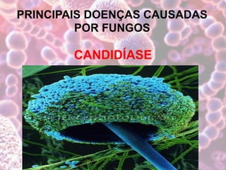 PRINCIPAIS DOENÇAS CAUSADAS
POR FUNGOS
CANDIDÍASE
 