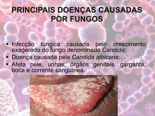 PRINCIPAIS DOENÇAS CAUSADAS
POR FUNGOS
 Infecção fúngica causada pelo crescimento
exagerado do fungo denominado Candida;
 Doença causada pela Candida albicans;
 Afeta pele, unhas, órgãos genitais, garganta,
boca e corrente sanguínea.
 