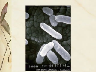 100 micra 10-6
metro
 