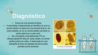 ● Exame de uma amostra de fezes
● A ascaridíase é diagnosticada ao identificar os ovos ou
vermes adultos no exame de uma amostra fecal ou, em
raras ocasiões, ao ver os vermes adultos nas fezes ou
saindo pela boca ou pelo nariz.
● Se a tomografia computadorizada (TC) ou
ultrassonografia for feita por outras razões, os vermes
adultos podem ser vistos. A observação em uma
radiografia do tórax da migração das larvas pelos
pulmões ocorre raramente.
Diagnóstico
 