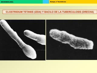 Biología. 2º BachilleratoMICROBIOLOGÍA
CLOSTRIDIUM TETANIS (IZDA) Y BACILO DE LA TUBERCULOSIS (DRECHA)
 