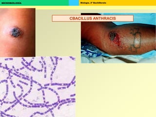 Biología. 2º BachilleratoMICROBIOLOGÍA
CBACILLUS ANTHRACIS
 