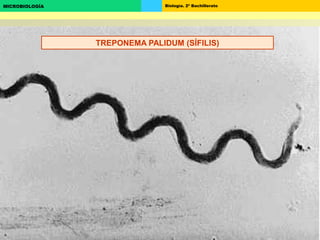 Biología. 2º BachilleratoMICROBIOLOGÍA
TREPONEMA PALIDUM (SÍFILIS)
 