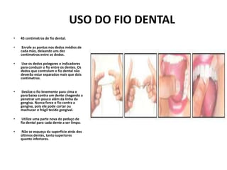 USO DO FIO DENTAL
• 45 centímetros de fio dental.
• Enrole as pontas nos dedos médios de
cada mão, deixando uns dez
centímetros entre os dedos.
• Use os dedos polegares e indicadores
para conduzir o fio entre os dentes. Os
dedos que controlam o fio dental não
deverão estar separados mais que dois
centímetros.
• Deslize o fio levemente para cima e
para baixo contra um dente chegando a
penetrar um pouco além da linha da
gengiva. Nunca force o fio contra a
gengiva, pois ele pode cortar ou
machucar o frágil tecido gengival.
• Utilize uma parte nova do pedaço de
fio dental para cada dente a ser limpo.
• Não se esqueça da superfície atrás dos
últimos dentes, tanto superiores
quanto inferiores.
 