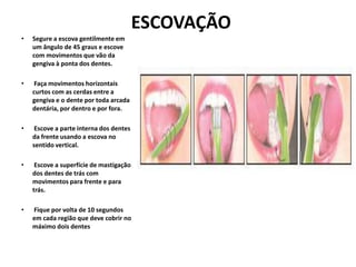 ESCOVAÇÃO
• Segure a escova gentilmente em
um ângulo de 45 graus e escove
com movimentos que vão da
gengiva à ponta dos dentes.
• Faça movimentos horizontais
curtos com as cerdas entre a
gengiva e o dente por toda arcada
dentária, por dentro e por fora.
• Escove a parte interna dos dentes
da frente usando a escova no
sentido vertical.
• Escove a superfície de mastigação
dos dentes de trás com
movimentos para frente e para
trás.
• Fique por volta de 10 segundos
em cada região que deve cobrir no
máximo dois dentes
 