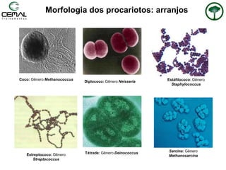 Morfologia dos procariotos: arranjos
Estreptococo: Gênero
Streptococcus
Estáfilococo: Gênero
Staphylococcus
Coco: Gênero Methanococcus
Sarcina: Gênero
Methanosarcina
Tétrade: Gênero Deinococcus
Diplococo: Gênero Neisseria
 