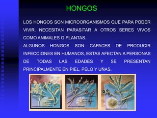 HONGOS
LOS HONGOS SON MICROORGANISMOS QUE PARA PODER
VIVIR, NECESITAN PARASITAR A OTROS SERES VIVOS
COMO ANIMALES O PLANTAS.
ALGUNOS   HONGOS    SON    CAPACES     DE    PRODUCIR
INFECCIONES EN HUMANOS, ESTAS AFECTAN A PERSONAS
DE   TODAS    LAS    EDADES    Y     SE     PRESENTAN
PRINCIPALMENTE EN PIEL, PELO Y UÑAS.
 