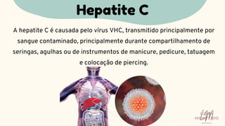 A hepatite C é causada pelo vírus VHC, transmitido principalmente por
sangue contaminado, principalmente durante compartilhamento de
seringas, agulhas ou de instrumentos de manicure, pedicure, tatuagem
e colocação de piercing.
Hepatite C
LUMA
MONTEIRO
LM
O D O N T O L O G I A
 
