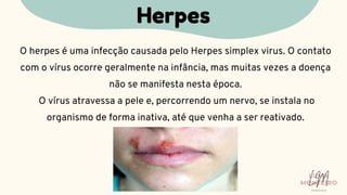 O herpes é uma infecção causada pelo Herpes simplex virus. O contato
com o vírus ocorre geralmente na infância, mas muitas vezes a doença
não se manifesta nesta época.
O vírus atravessa a pele e, percorrendo um nervo, se instala no
organismo de forma inativa, até que venha a ser reativado.
Herpes
LUMA
MONTEIRO
LM
O D O N T O L O G I A
 