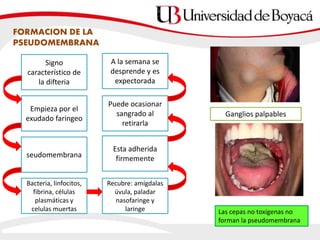Signo
característico de
la difteria
Empieza por el
exudado faringeo
seudomembrana
Bacteria, linfocitos,
fibrina, células
plasmáticas y
celulas muertas
Recubre: amígdalas
úvula, paladar
nasofaringe y
laringe
Esta adherida
firmemente
Puede ocasionar
sangrado al
retirarla
A la semana se
desprende y es
expectorada
Las cepas no toxígenas no
forman la pseudomembrana
FORMACION DE LA
PSEUDOMEMBRANA
Ganglios palpables
 
