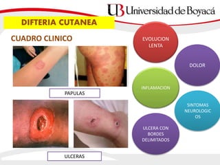 CUADRO CLINICO
INFLAMACION
DOLOR
EVOLUCION
LENTA
SINTOMAS
NEUROLOGIC
OS
DIFTERIA CUTANEA
PAPULAS
ULCERAS
ULCERA CON
BORDES
DELIMITADOS
 