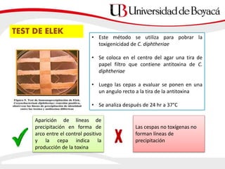 TEST DE ELEK
• Este método se utiliza para pobrar la
toxigenicidad de C. diphtheriae
• Se coloca en el centro del agar una tira de
papel filtro que contiene antitoxina de C.
diphtheriae
• Luego las cepas a evaluar se ponen en una
un angulo recto a la tira de la antitoxina
• Se analiza después de 24 hr a 37°C
Aparición de líneas de
precipitación en forma de
arco entre el control positivo
y la cepa indica la
producción de la toxina
Las cespas no toxígenas no
forman líneas de
precipitación
 