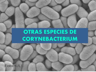OTRAS ESPECIES DE
CORYNEBACTERIUM
 