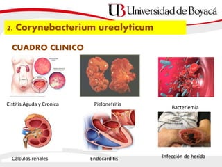 2. Corynebacterium urealyticum
CUADRO CLINICO
Cistitis Aguda y Cronica Pielonefritis
Bacteriemia
Endocarditis Infección de heridaCálculos renales
 