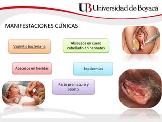 MANIFESTACIONES CLÍNICAS
Vaginitis bacteriana
Abscesos en cuero
cabelludo en neonatos
Abscesos en heridas Septicemias
Parto prematuro y
aborto
 