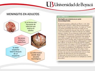 MENINGITIS EN ADULTOS
Es la forma mas
frecuente de
infección por
listeria en
adultos
No posee
síntomas
específicos
Se debe
sospechar
listeria después
de un
trasplante
La enfermedad
puede dejar
secuelas
neurológicas
 