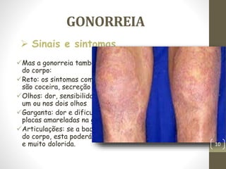 GONORREIA
Mas a gonorreia também pode surgir em outras partes
do corpo:
Reto: os sintomas comuns da gonorreia na região anal
são coceira, secreção de pus e sangramentos
Olhos: dor, sensibilidade à luz e secreção de pus em
um ou nos dois olhos
Garganta: dor e dificuldade em engolir, presença de
placas amareladas na garganta
Articulações: se a bactéria afetar alguma articulação
do corpo, esta poderá ficar quente, vermelha, inchada
e muito dolorida.
 Sinais e sintomas
10
 