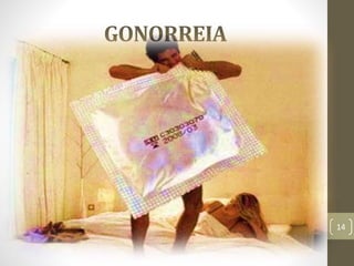 GONORREIA
Use preservativo em todo e qualquer tipo de contato
sexual, seja ele vaginal, anal ou oral.
Evite ter relações sexuais com pessoas diagnosticadas
com gonorreia até que estejam completamente
tratadas.
Para evitar futuras transmissões da infecção, é
importante também que todos os parceiros ou
parceiras sexuais sejam tratados. A doença pode
voltar caso não tenha recebido tratamento adequado.
 Prevenção
14
 
