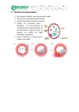 5° - Tipo III ou por Imunocomplexos:

        São ativadas- mediadas - por anticorpos IgG ou IgM.
        Precisam de uma relação imunocomplexos.
        Aparência de eritemas, edemas ou necrose.
        Casado por anticorpos livres –
        dissolvidos - ou da membrana de
        microrganismo que podem lesionar de
        maneira sistema - doença do soro- ou
        regional em tecidos ou órgão
        específicos – poliarterite.
        Leva em media de 2 a 8 horas para a
        reação se percebida.
 