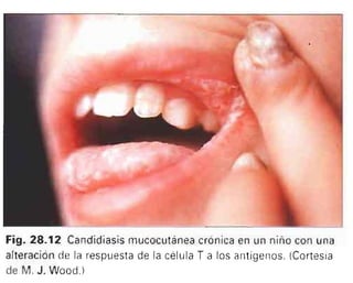 Microbiologia medica