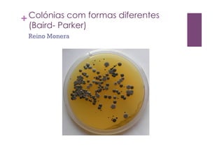 +Colónias com formas diferentes
(Baird- Parker)
Reino Monera
 
