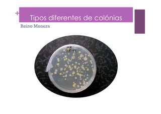 +
Tipos diferentes de colónias
Reino Monera
 