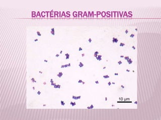 BACTÉRIAS GRAM-POSITIVAS