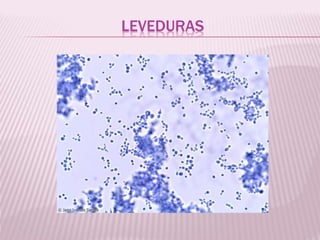 LEVEDURAS