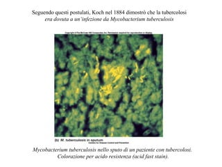 Seguendo questi postulati, Koch nel 1884 dimostrò che la tubercolosi
     era dovuta a un‘infezione da Mycobacterium tuberculosis




Mycobacterium tuberculosis nello sputo di un paziente con tubercolosi.
         Colorazione per acido resistenza (acid fast stain).
 