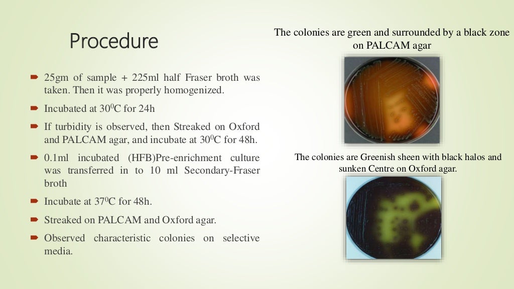 Microbiological Quality Analysis Isolation,Identificatin and Detect…